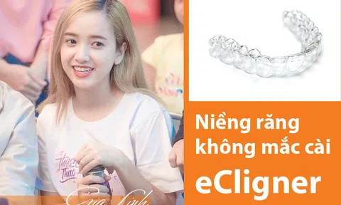 Gia Linh – “Vì yêu mà đến” tiết lộ niềng răng không mắc cài để nâng tầm nhan sắc