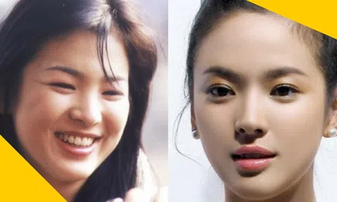 4 cách giảm béo mặt giúp phụ nữ luôn xinh tươi, rạng rỡ