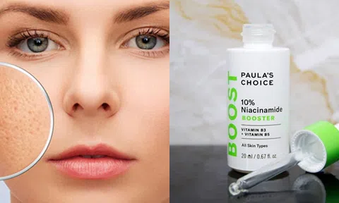 Mách nàng bí quyết se khít lỗ chân lông chỉ trong một nốt nhạc 