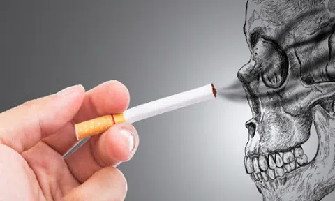 Ngày hút 20 điếu thuốc lá, nam bệnh nhân 25 tuổi bị nhồi máu cơ tim cấp