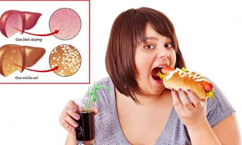 Phòng bệnh gan nhiễm mỡ bắt đầu từ chế độ ăn
