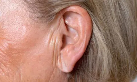 Dấu hiệu lạ ở tai báo hiệu cơn đau tim