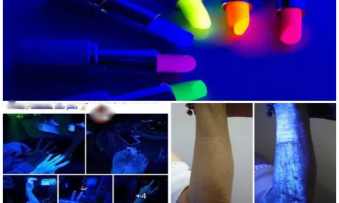 Dùng mỹ phẩm chứa chất huỳnh quang, làn da bị ăn mòn, hủy hoại nghiêm trọng