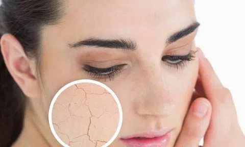 Thực phẩm khiến da bị khô, bạn nên hạn chế