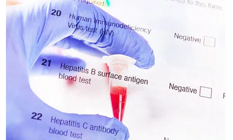 Những thực phẩm thân thiện với gan nên đưa vào chế độ ăn uống