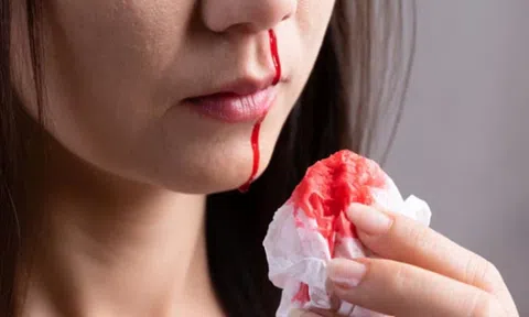 Nếu cơ thể chảy máu ở 5 vị trí sau, cần đi khám bác sĩ ngay vì có thể bạn đã mắc ung thư từ lâu mà không biết