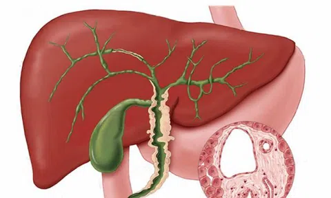 Những người cần đặc biệt quan tâm đến sức khỏe của lá gan