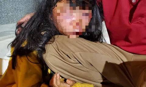 Điều tra vụ nữ sinh lớp 6 bị đánh đập dã man trên đường đi học về