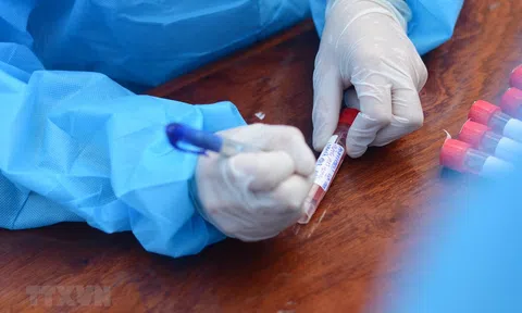 Việt Nam ghi nhận thêm 28 ca mắc mới COVID-19 trong sáng 11/5