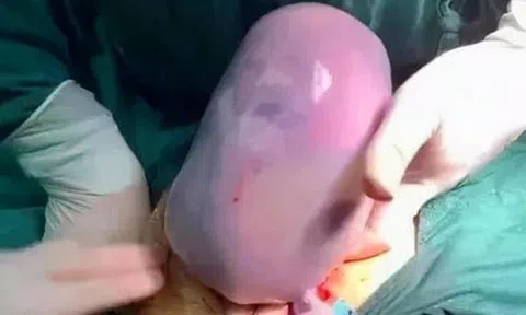 Thấy con chào đời, bố sợ không dám bế nhưng bác sĩ lại chúc mừng