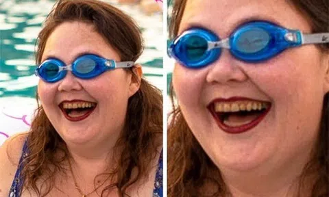 7 thói quen cần bỏ ngay nếu không muốn răng ố vàng, xỉn màu gây mất thẩm mỹ