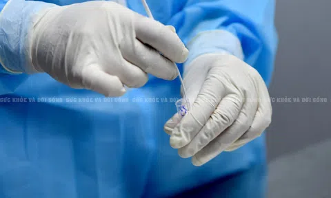 Thêm 5 người mắc bệnh, Nghệ An có tổng cộng 77 ca dương tính với SARS-CoV-2