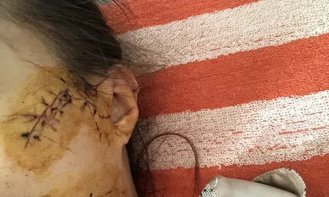 Điều tra vụ vợ làm tăng ca, chồng mang dao đến xưởng chém: Lời kể kinh hoàng của nạn nhân