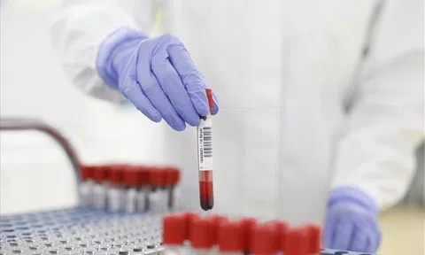 Hà Nội thêm 14 ca mắc COVID-19, trong đó có 2 ca là tiểu thương buôn bán ở chợ