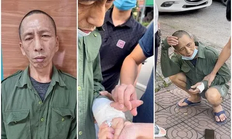 Phát hiện "con nghiện" vờ bó bột tay để cất giấu ma túy mang đi bán