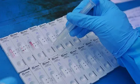 TP.HCM đề nghị cấp mã số cho 150.000 người có kết quả test nhanh dương tính Covid-19