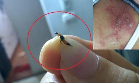Mẹo đuổi kiến ba khoang sạch bách, không tốn một xu