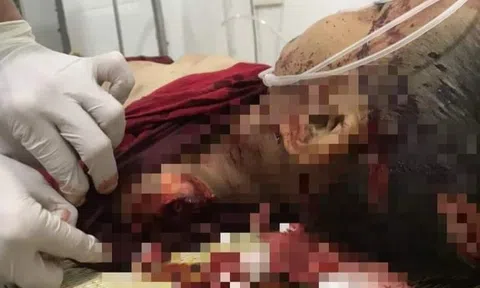 Điều tra vụ bé trai lớp 3 tử vong với nhiều vết thương, nghi bị sát hại