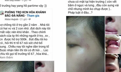 Làm rõ vụ dân "tố" bị đánh khi đi hỏi tiền hỗ trợ Covid-19