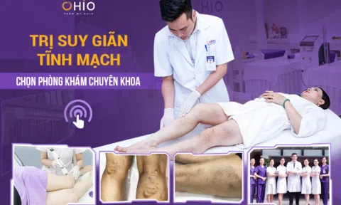 Kinh nghiệm trị giãn tĩnh mạch từ chuyên gia da liễu đầu ngành