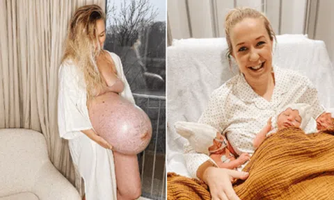 Cư dân mạng choáng váng chiếc bụng bầu “dị thường” của người phụ nữ sinh 3