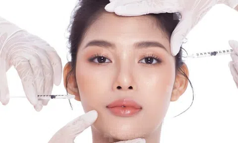 Lầm tưởng về tiêm filler