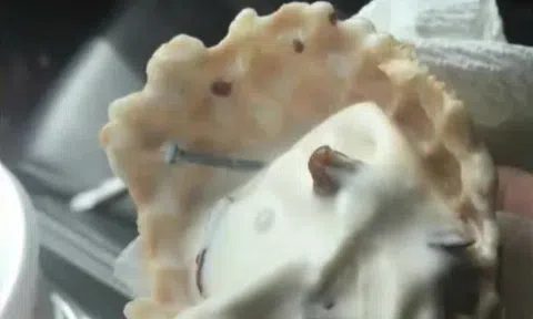 Nuốt phải đinh khi ăn kem, người mẹ 2 con được đền bù số tiền "khủng"