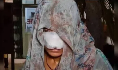 Rợn người cảnh chồng cắn mặt vợ như thời trung cổ vì mâu thuẫn gia đình, anh trai hé lộ tình tiết đau lòng