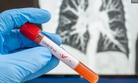 Gần 10.000 người tử vong vì Covid-19 trong tháng 12/2023