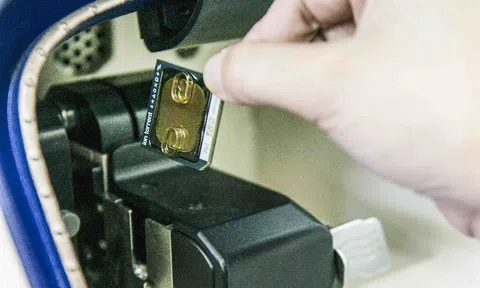 NIPT là gì? Tại sao các mẹ nên làm xét nghiệm NIPT?