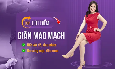 Review trị giãn mao mạch thực tế tại Thẩm mỹ OHIO