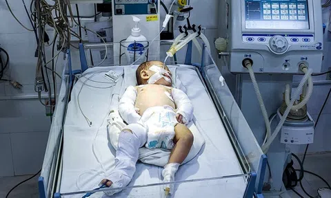 Lâm Đồng: Bắt nghi phạm bạo hành con gái 2 tháng tuổi của người tình