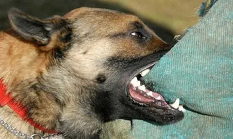 Người đàn ông tử vong sau khoảng 3 tháng bị chó cắn