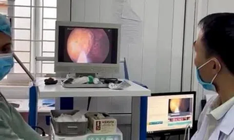 Ăn 1kg hồng giòn, người đàn ông bị chảy máu dạ dày suýt mất mạng
