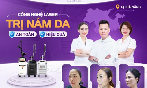Điều trị nám da bằng Laser an toàn, hiệu quả tại Đà Nẵng