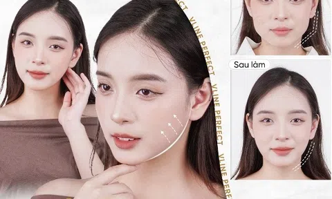 Giải mã công nghệ gọn hàm “không cần dao kéo”