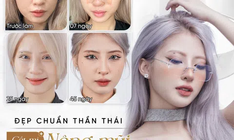“Tôn thờ” vẻ đẹp tự nhiên, dáng mũi đẹp bền vững tại thẩm mỹ viện Tấm đốn tim những tín đồ làm đẹp