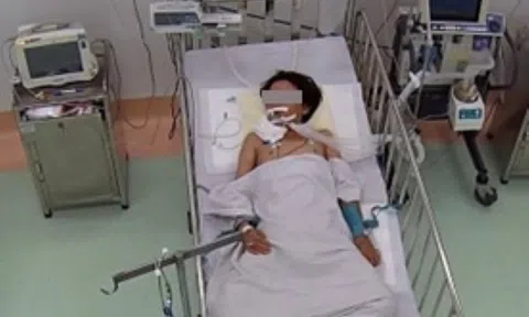 Ngủ dưới nền nhà, bé 13 tuổi bị rắn độc cắn nguy kịch