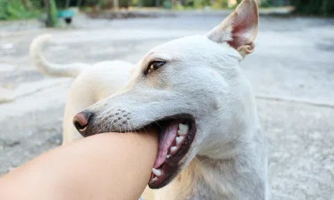 Cấp cứu cháu bé 13 tháng tuổi bị chó cắn khi sang nhà hàng xóm chơi