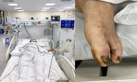 Cứu sống người đàn ông co cứng toàn thân sau khi cọc nhọn đâm vào chân