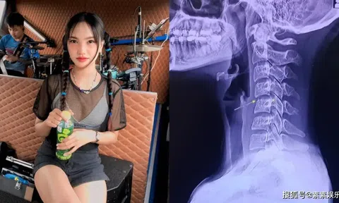 Thái Lan: Công bố nguyên nhân vụ nữ ca sĩ qua đời sau khi đi massage