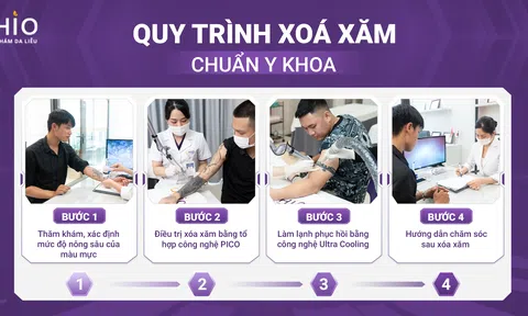 Tiết kiệm thời gian với phác đồ Xóa xăm Pico 3X tại Phòng khám OHIO