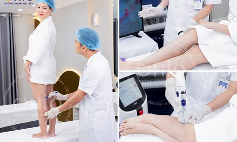 Ngày hội trị giãn mao mạch “Hành động vì sức khỏe và thẩm mỹ đôi chân”