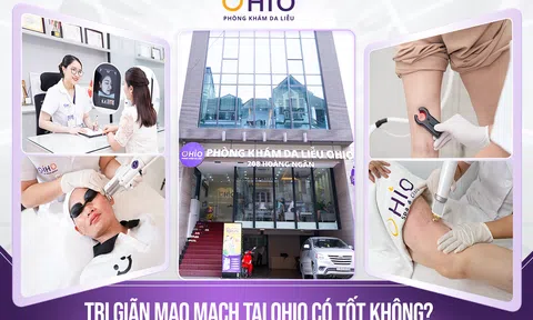 Trị giãn mao mạch tại Phòng khám da liễu OHIO có tốt không?