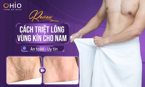 Review cách triệt lông vùng kín cho Nam an toàn, uy tín?