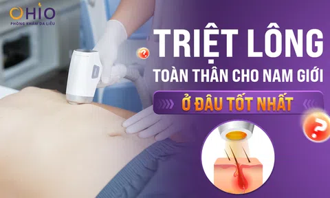 Triệt lông toàn thân cho nam giới ở đâu tốt nhất?