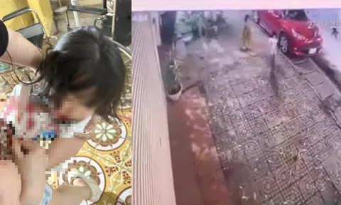 Clip: Kinh hoàng bé gái bị chó dữ lao vào cắn khi đang đi trên vỉa hè