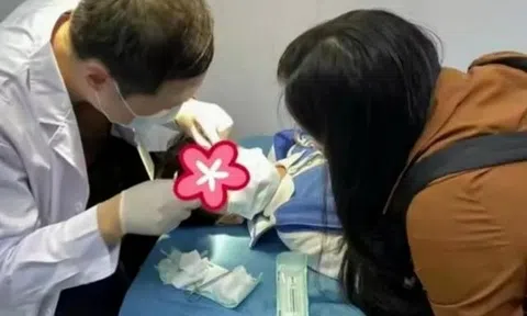 Bé 3 tuổi bị dính keo 502 vào mắt, mẹ làm ngay 2 thao tác cứu được đôi mắt con
