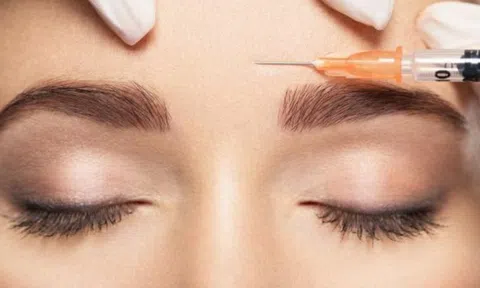 Trải nghiệm kinh hoàng của một phụ nữ sau khi tiêm botox