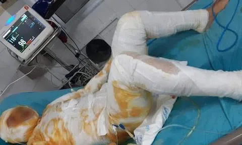 Khởi tố người chồng đổ xăng thiêu sống vợ